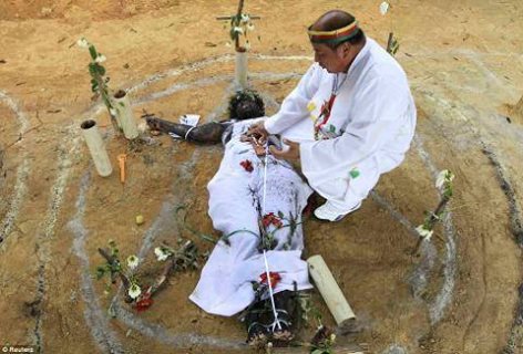 4 قضبان حديدية في معدة مشعوذ نيبالي