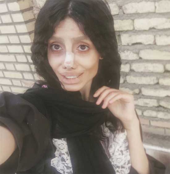  50 عملية تجميل كي تبدو مثل أنجيلينا جولي